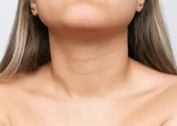 старение шеи