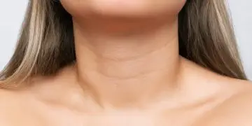 старение шеи