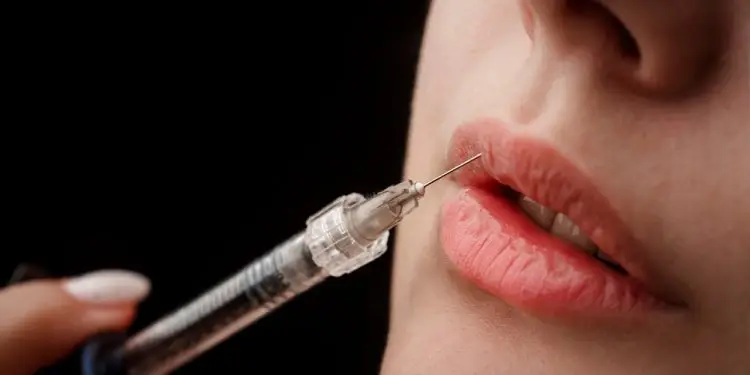 Прочтите эту памятку, если собираетесь колоть филлеры