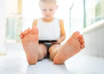 заболевания среди детей