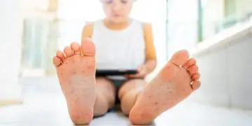 заболевания среди детей