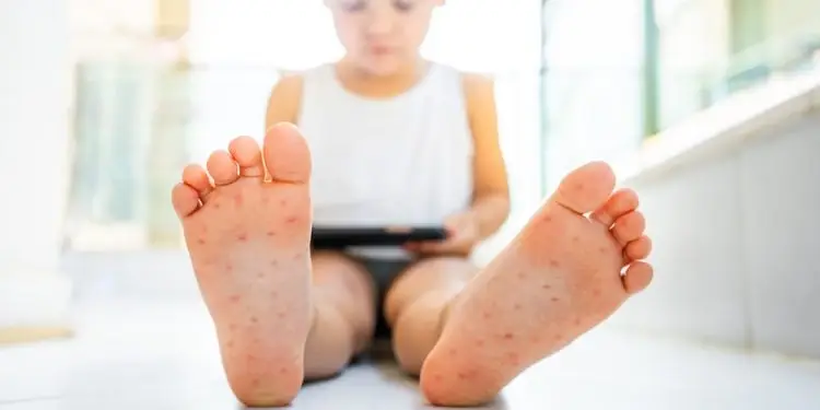 заболевания среди детей