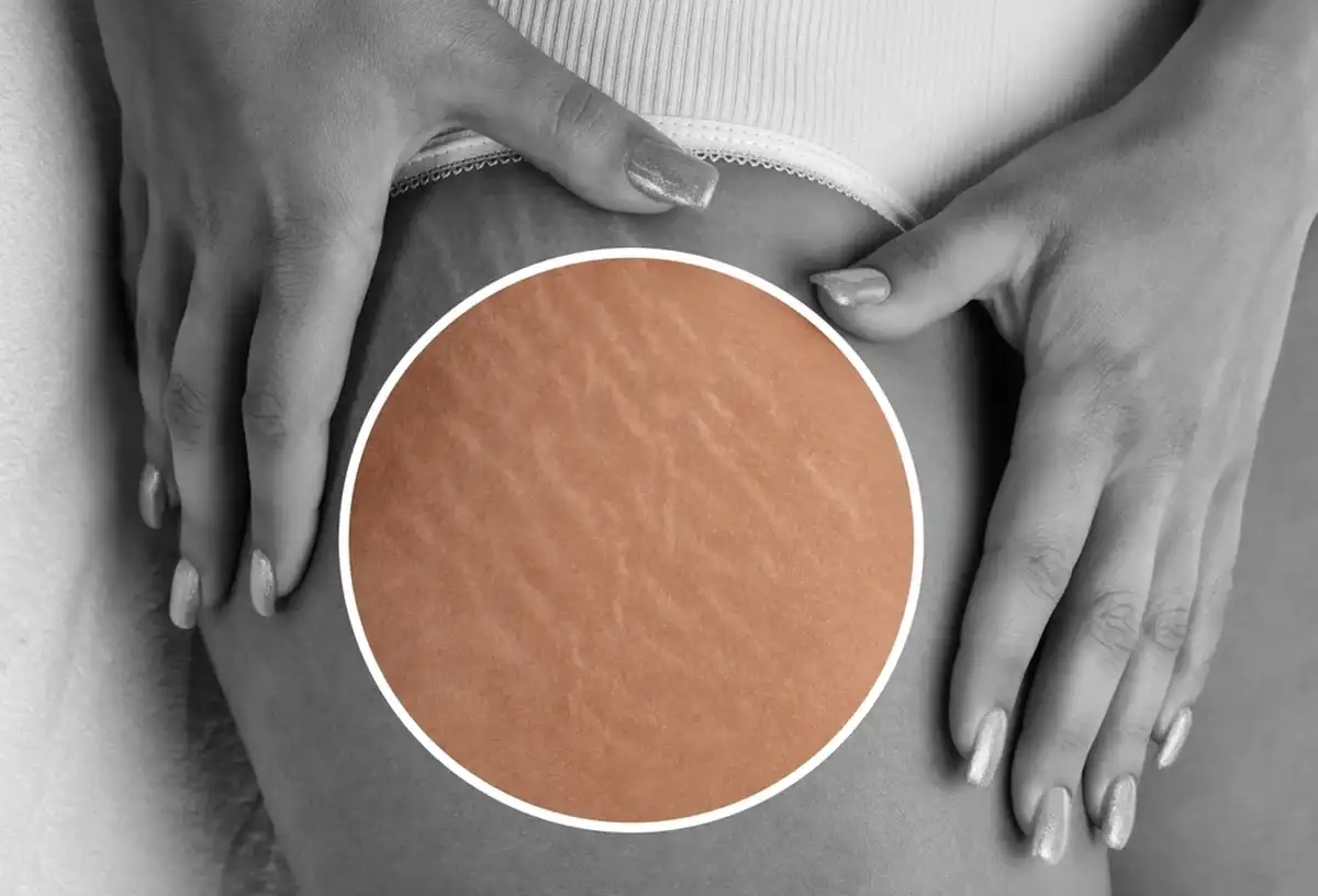 Фото: Shutterstock